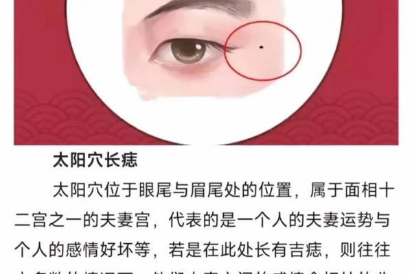 去痣命理解析:去痣真能改变命运吗?合婚时痣的位置又该怎么看? 去痣命理解析:去痣真能改变命运吗?合婚时痣的位置又该怎么看?